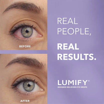 LUMIFY Redness Reliever Eye Drops (2.5mL)