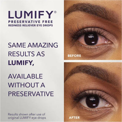 LUMIFY Redness Reliever Preservative Free Eye Drops